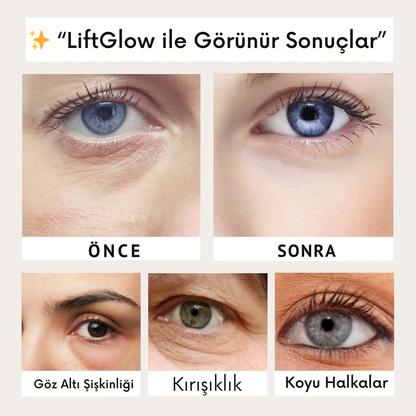 MedikalEvin™ LiftGlow (Anında Gençlik Serumu)