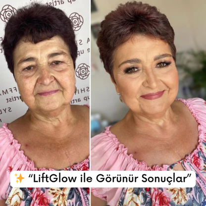 MedikalEvin™ LiftGlow (Anında Gençlik Serumu)