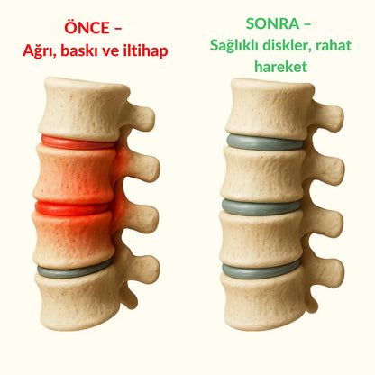 Medikalevin™ OrtoFlex Siyatik & Bel Masaj Aleti