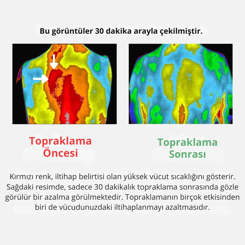 Medikal Evin Topraklanma Çarşafı