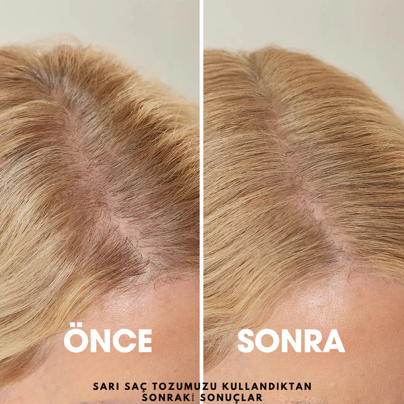 MedikalEvin Root'd™ Saç Kök Güçlendirici Kapatıcı Pudra (48 Saat Kalıcı Etki)