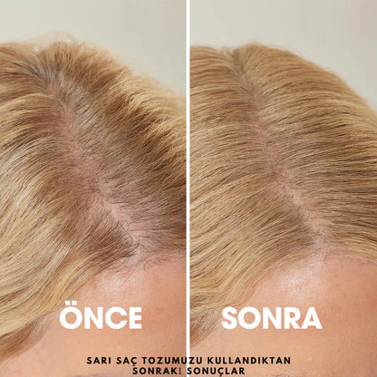 MedikalEvin Root'd™ Saç Kök Güçlendirici Kapatıcı Pudra (48 Saat Kalıcı Etki)